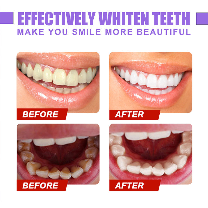 Dental Color Corrector
