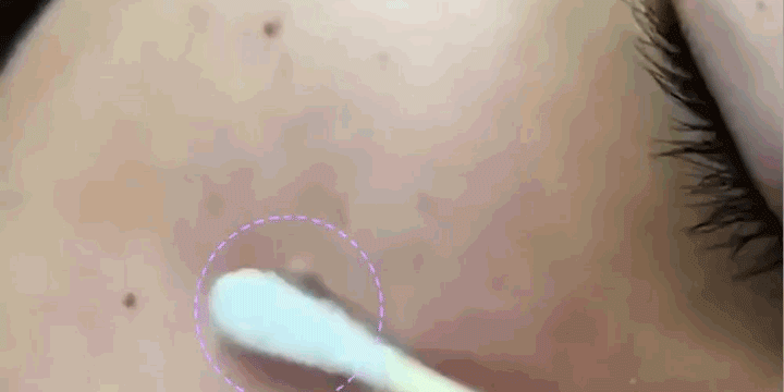 Spot Removal Moisturizer