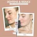 Face Freckle Removal Cream