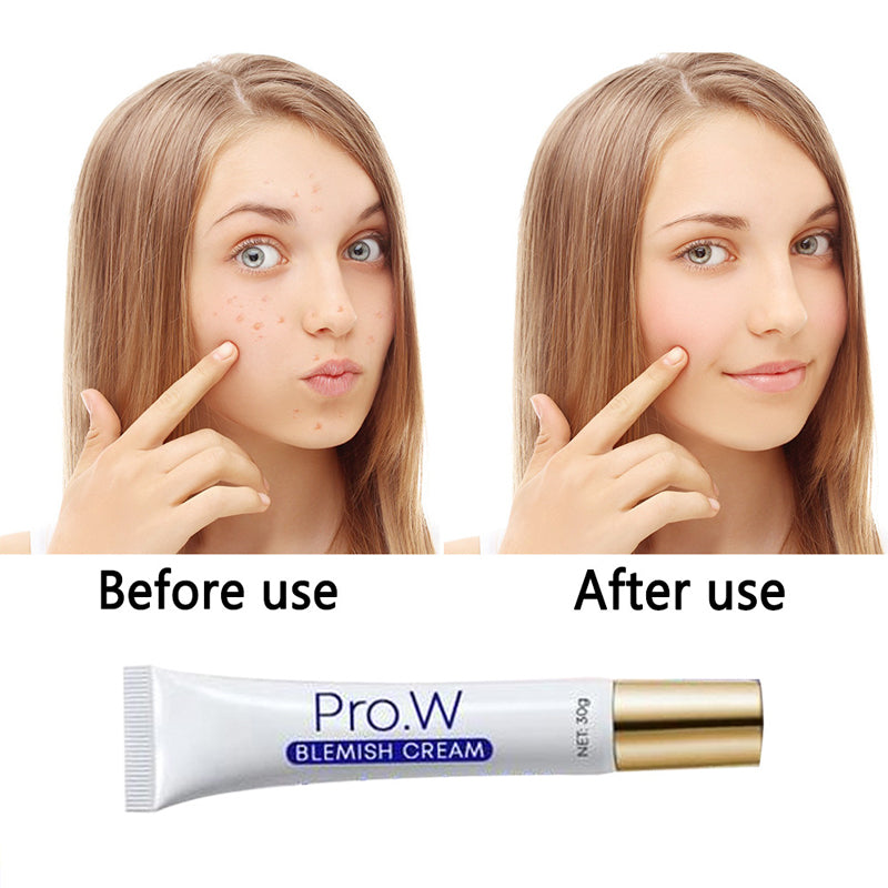 Spot Removal Moisturizer