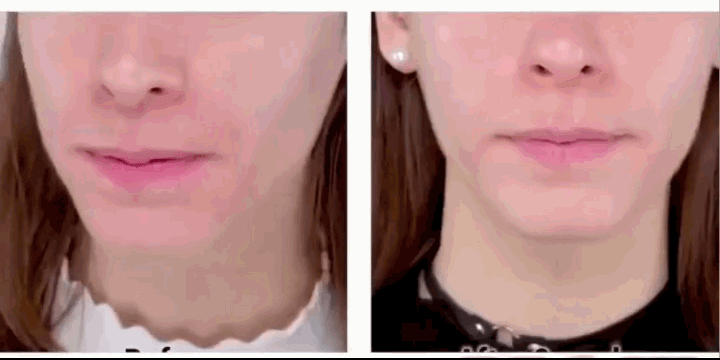 Spot Removal Moisturizer